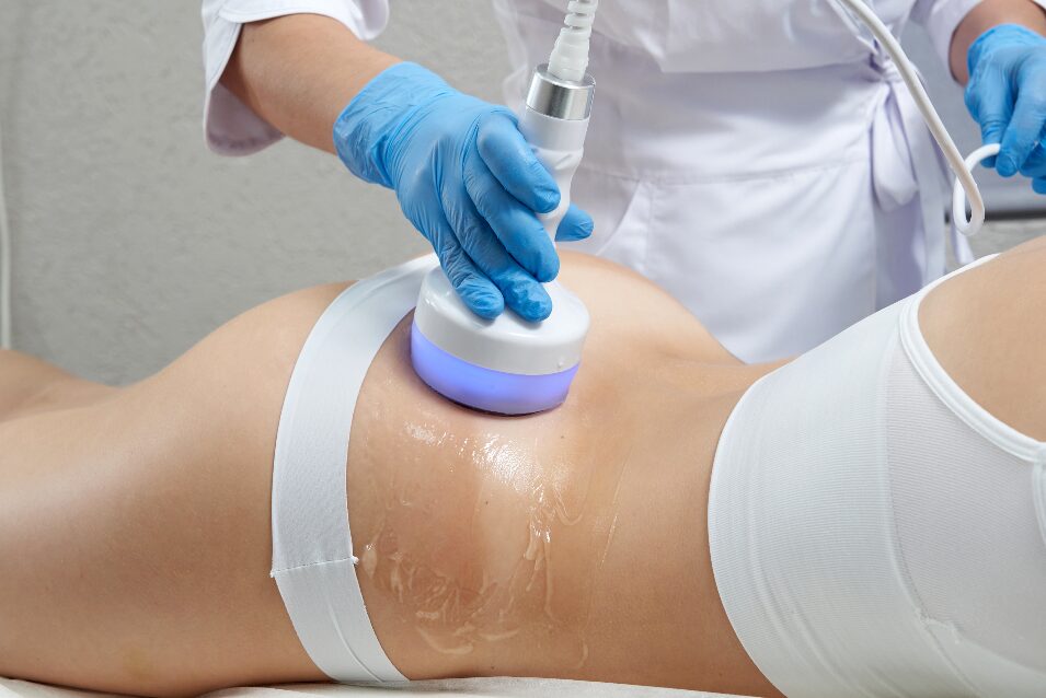 Ultrasonic Cavitation Body Shaping